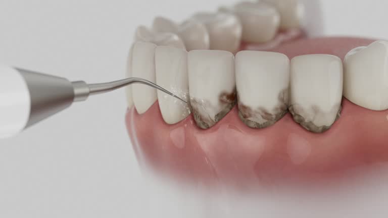 Reliable Dental Implants contractor in Grundy, VA by Smile Center Dentistry